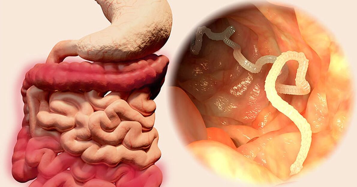 parasites dans l'intestin humain