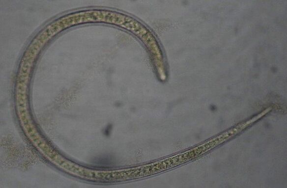 Trichinella est un ver parasite rond à protostome