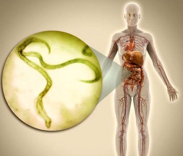 Parasites dans le corps