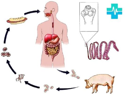 Façons d'infection